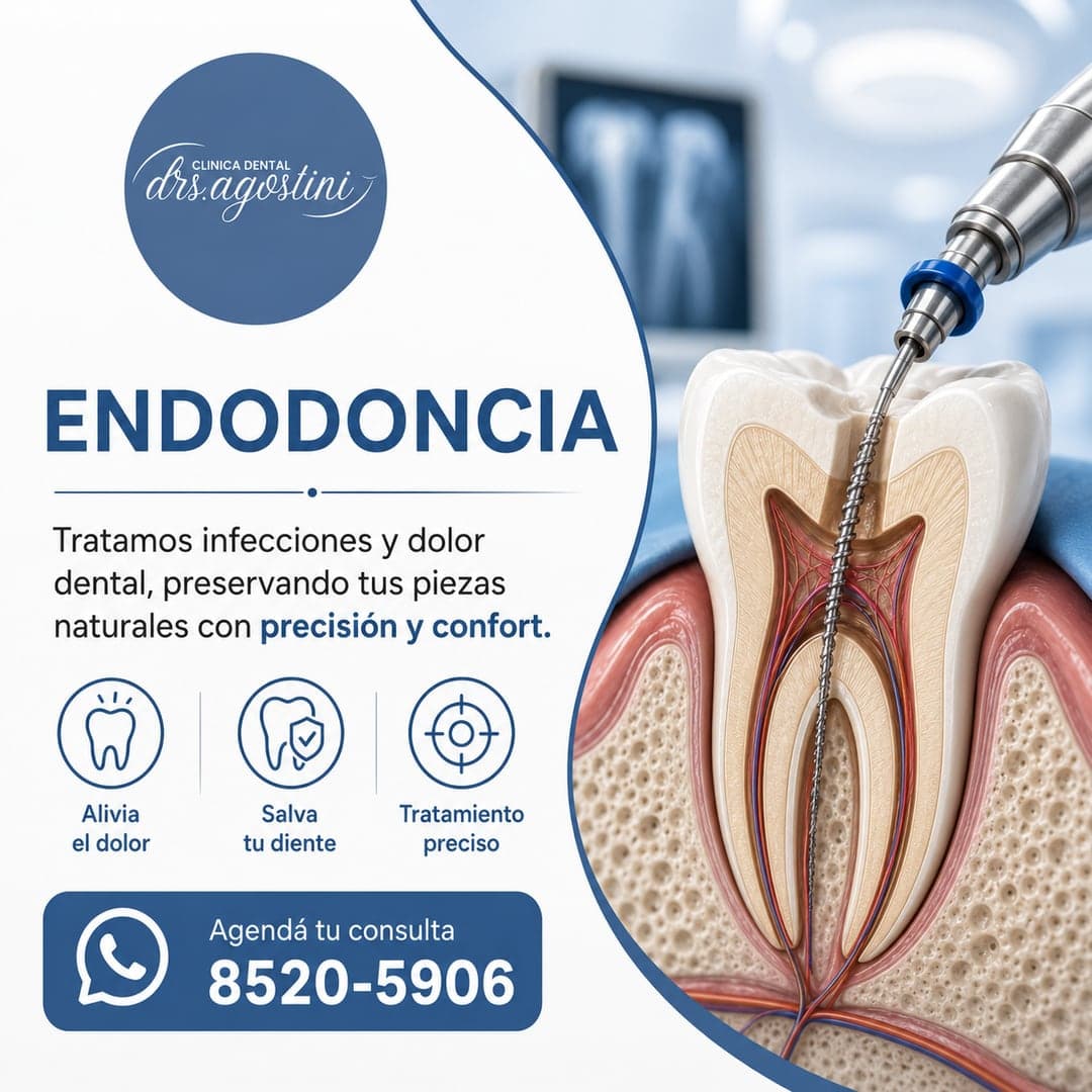 Endodoncia en Cartago — Clínica Dental Drs. Agostini