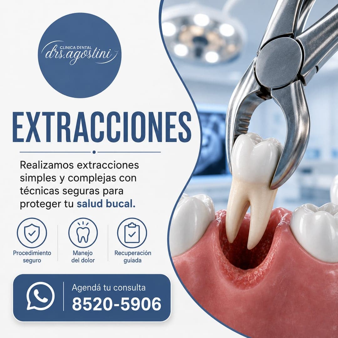 Extracciones en Cartago — Clínica Dental Drs. Agostini