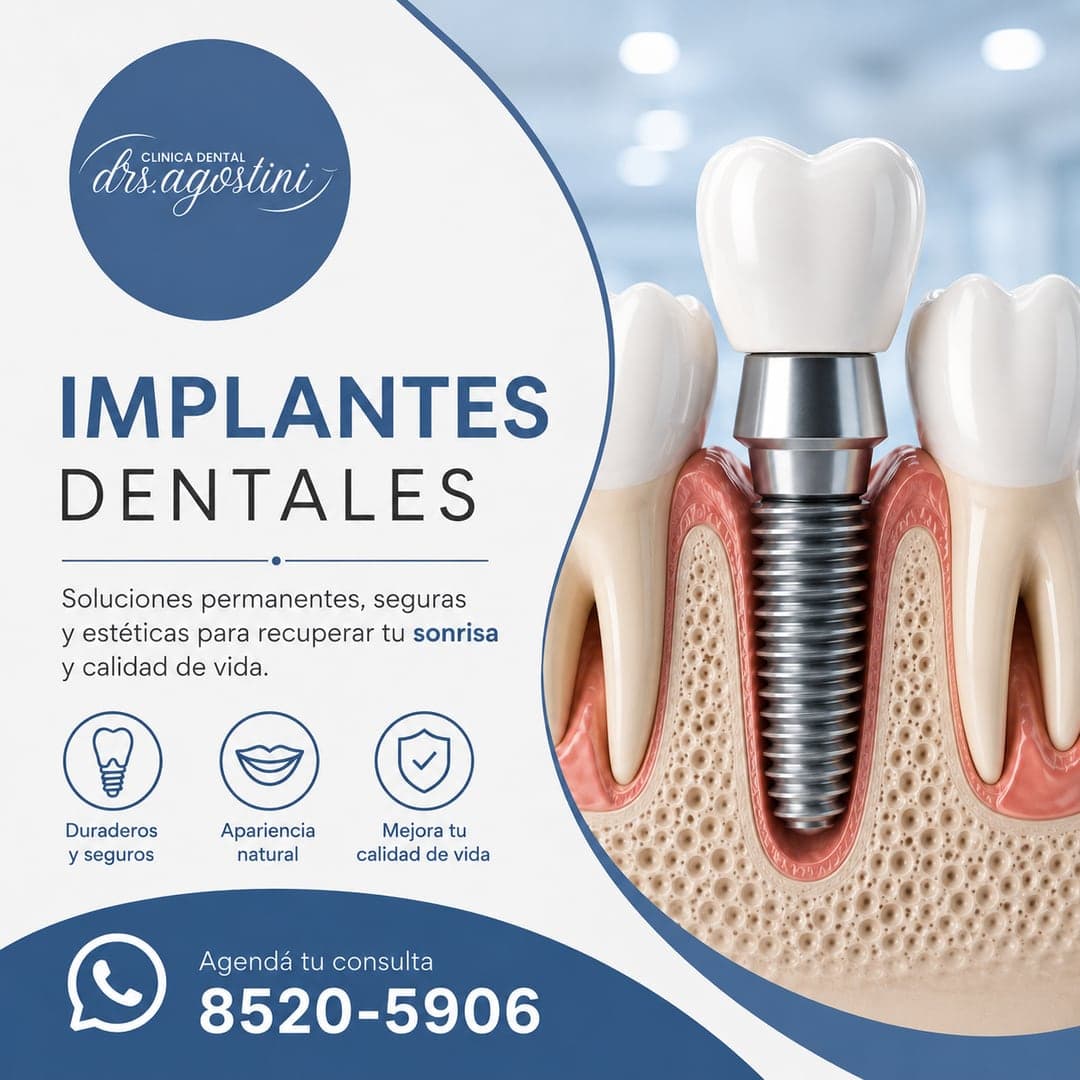 Implantes Dentales en Cartago — Clínica Dental Drs. Agostini